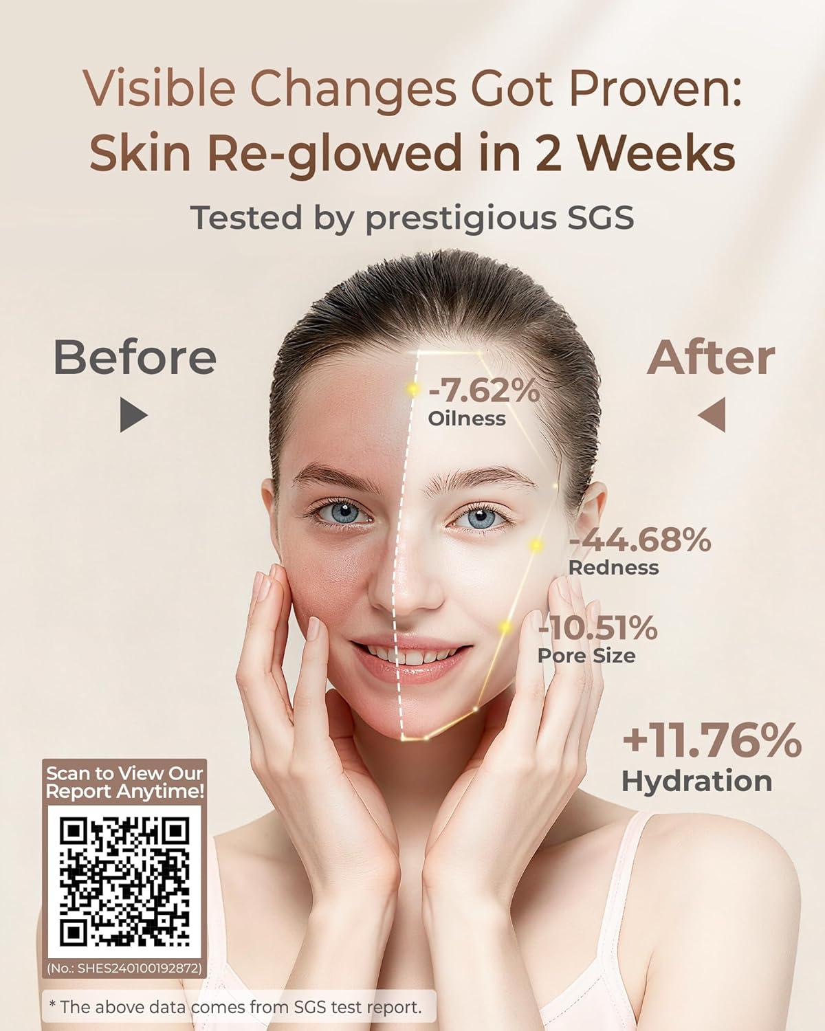 imageWaterdrop Water Filter for Sink Faucet 4000 Gallons Countertop Water Filter System and Filter Life Reminder Reduces Heavy Metals Bad Odor and 99 Chlorine WDCTF05 1 FilterSkincare Face Washer